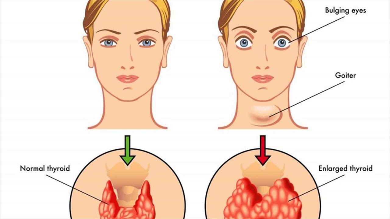 Gambar STRUMA - Klinika Digjitale